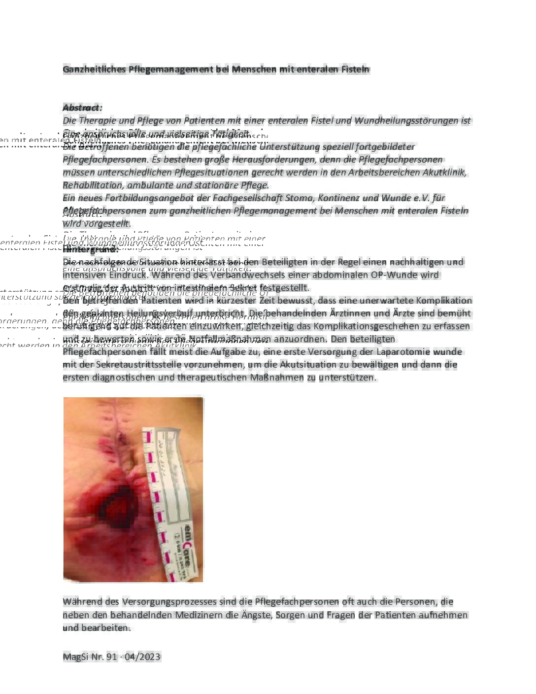 FA_GanzheitlichesPflegemanagementBeiMenschenMitEnteralenFisteln