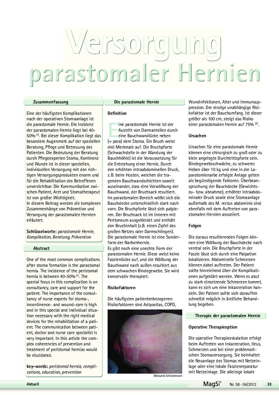 Parastomale Hernien PDF